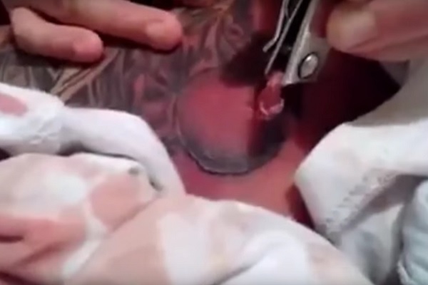 This Disgusting Video Will Convince You Never To Have A Tattoo