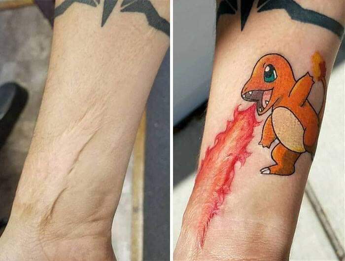 Those unwanted spots and scars! (12 Pics)
