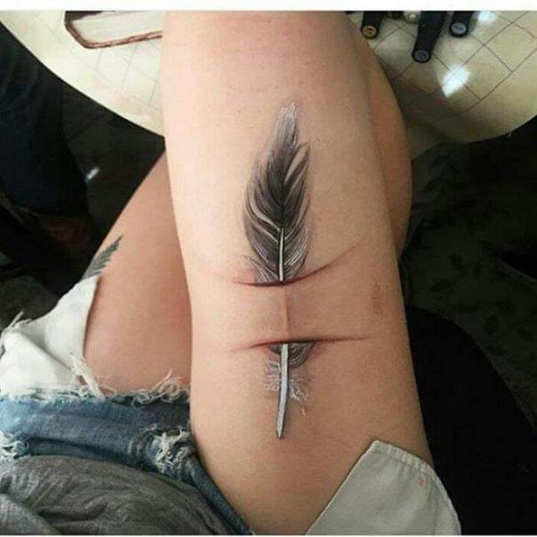 Amazing tattoos that turn scars into works of art! (15 Pics)