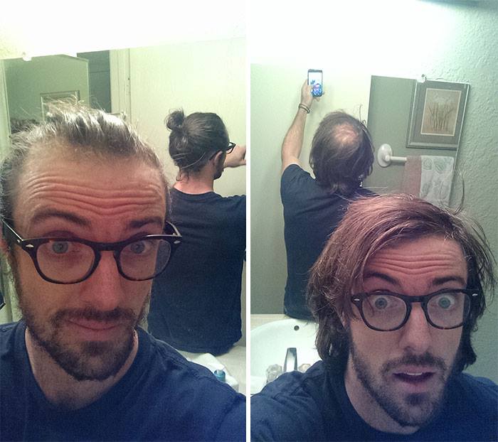 Smart People: 10 People Who Found Amazing Ways To Hide Their Bald Patches