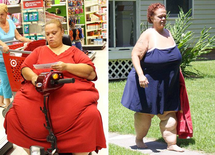 25 Unbelievable Before & After Transformation Pics
