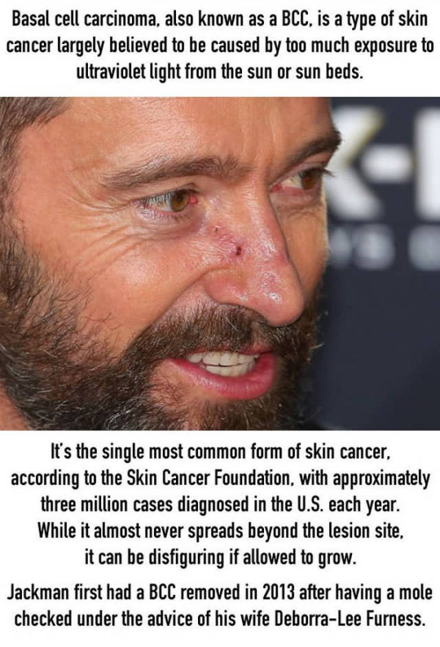 Hugh Jackman Warns His Fans About What He Had Learned About Cancer In A Hard Way (7 pics)