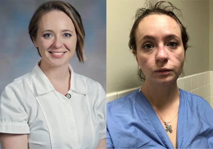 Catherine Ivy - This Nurse Shows Her Photos Of Before And After Nine Months Of Pandemic!