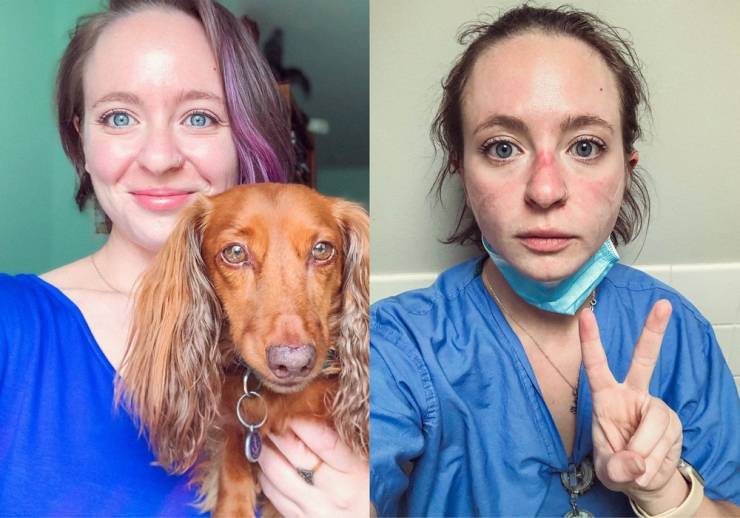 Catherine Ivy - This Nurse Shows Her Photos Of Before And After Nine Months Of Pandemic!